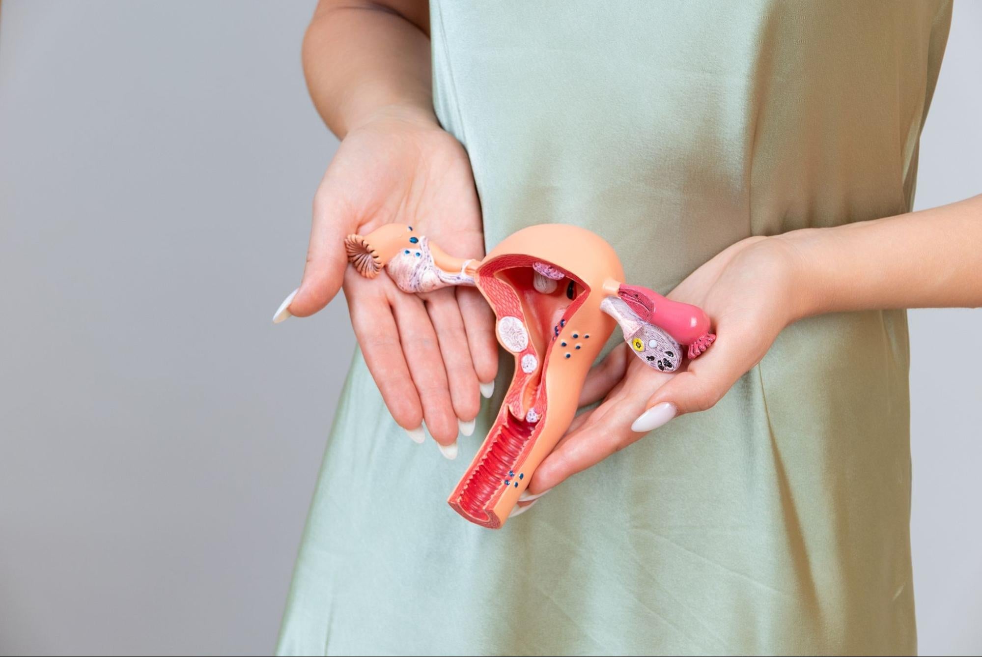 Endometriosis: qué es, síntomas y cómo afecta a tu salud